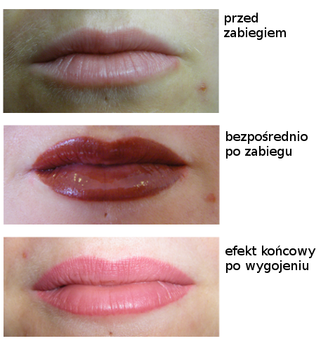 Pigmentacja Ust, Makijaż Permanentny, Makijaż Trwały :: Beauty Projekt ...